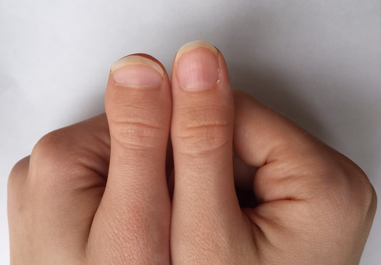 Which bone is short under a nail?